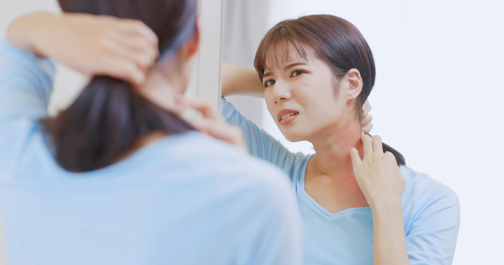 背中ニキビの原因の一つ「マラセチア」とは?