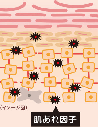 肌あれ因子