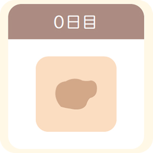 シミ取りレーザー照射後0日目の茶褐色のかさぶた